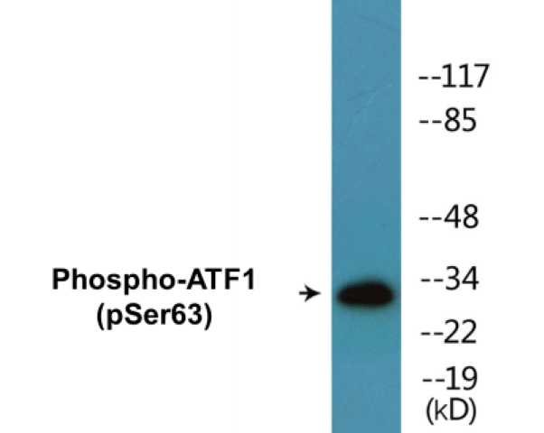 ATF1 (phospho Ser63) Cell Based ELISA Kit