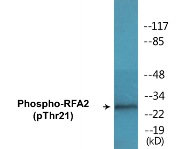RFA2 (phospho Thr21) Cell Based ELISA Kit