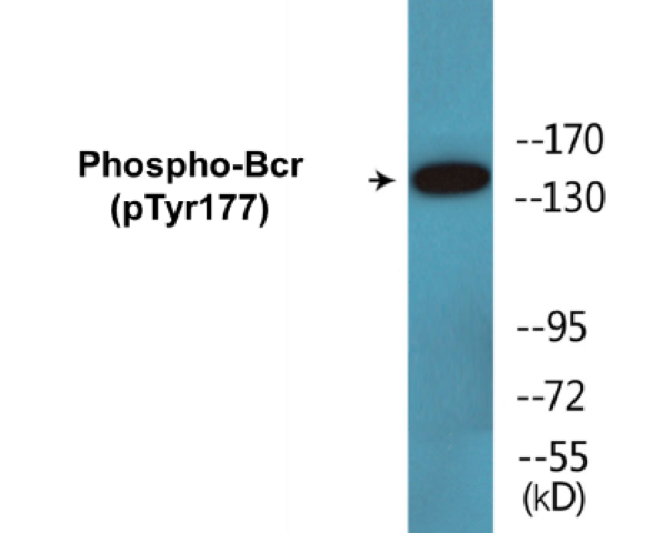 Bcr (phospho Tyr177) Cell Based ELISA Kit
