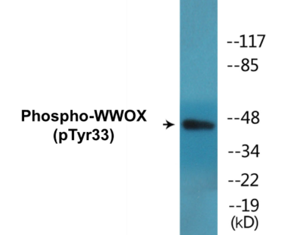 WWOX (phospho Tyr33) Cell Based ELISA Kit