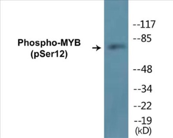 MYB (phospho Ser12) Cell Based ELISA Kit