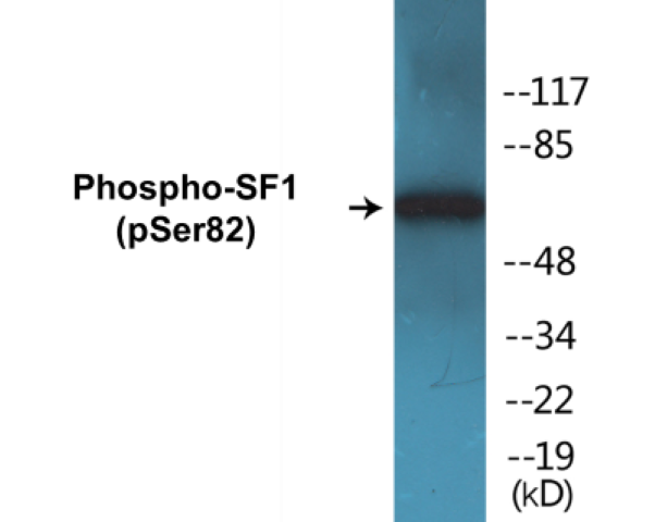SF1 (phospho Ser82) Cell Based ELISA Kit