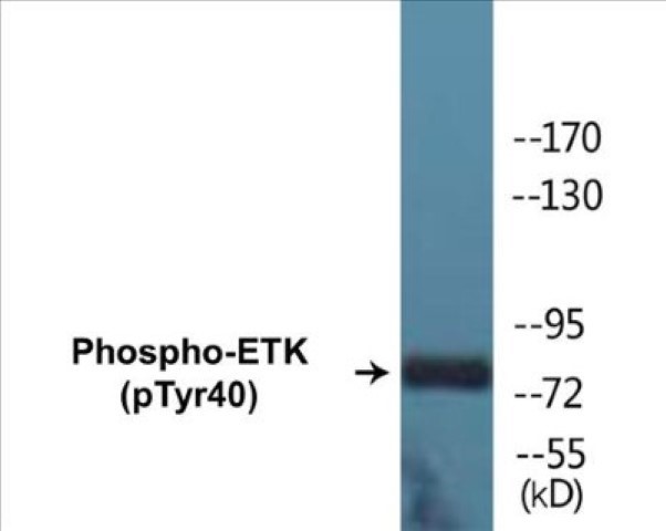 ETK (phospho Tyr40) Cell Based ELISA Kit