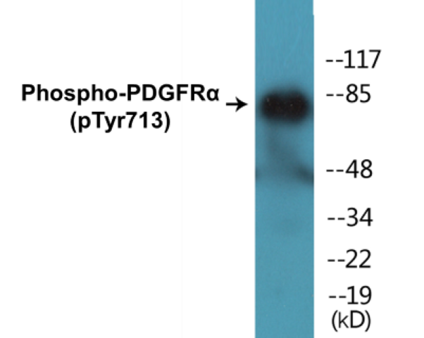 PDGFR alpha (phospho Tyr713) Cell Based ELISA Kit