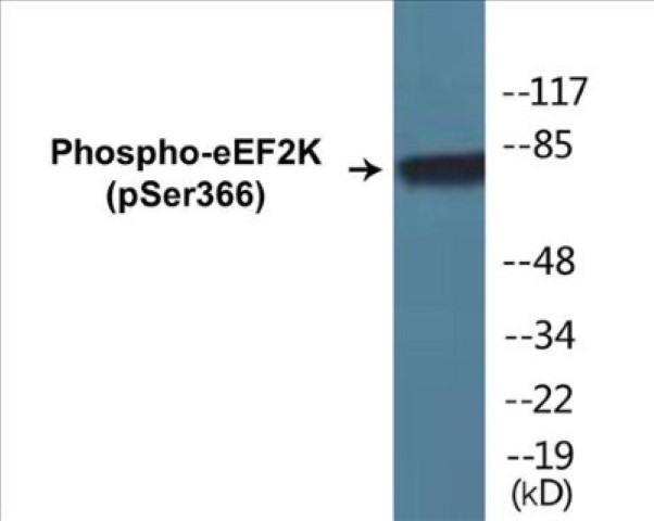eEF2K (phospho Ser366) Cell Based ELISA Kit