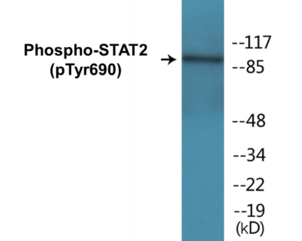 STAT2 (phospho Tyr690) Cell Based ELISA Kit