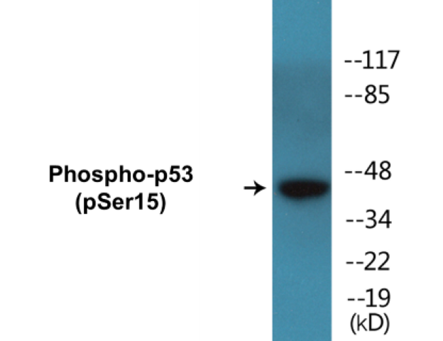 p53 (phospho Ser15) Cell Based ELISA Kit