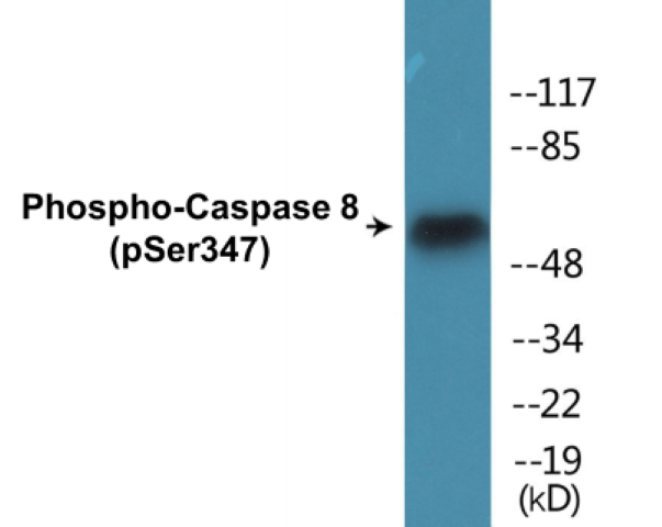 Caspase 8 (phospho Ser347) Cell Based ELISA Kit