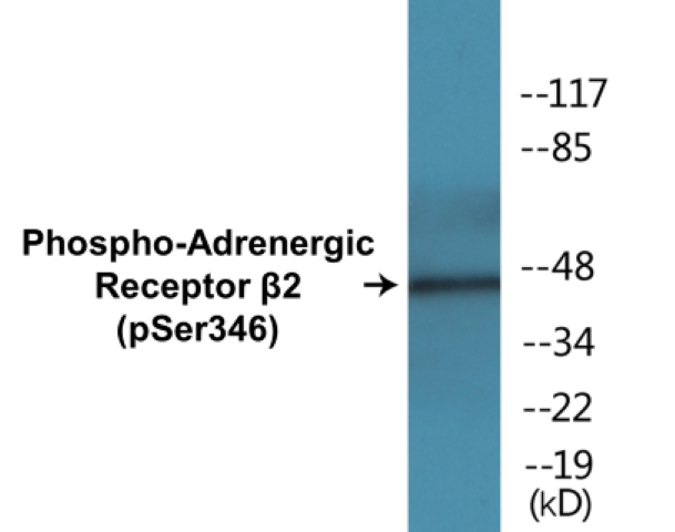 Adrenergic Receptor beta 2 (phospho Ser346) Cell Based ELISA Kit
