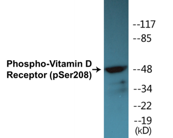 Vitamin D Receptor (phospho Ser208) Cell Based ELISA Kit
