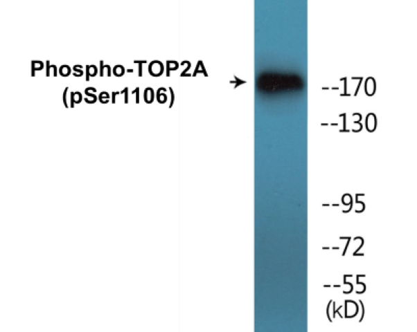TOP2A (phospho Ser1106) Cell Based ELISA Kit