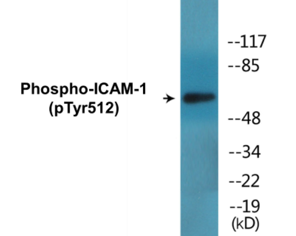 ICAM-1 (phospho Tyr512) Cell Based ELISA Kit