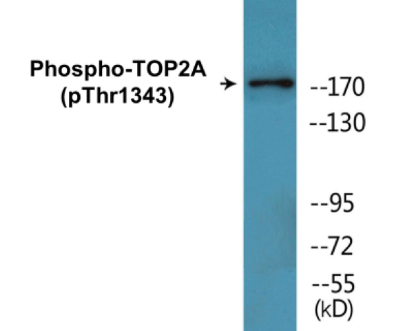 TOP2A (phospho Thr1343) Cell Based ELISA Kit