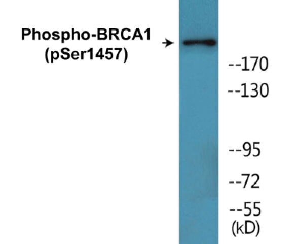 BRCA1 (phospho Ser1457) Cell Based ELISA Kit