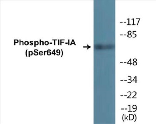 TIF-IA (phospho Ser649) Cell Based ELISA Kit