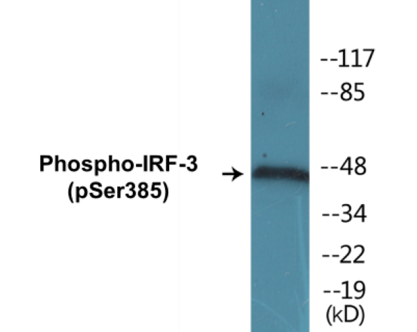 IRF-3 (phospho Ser385) Cell Based ELISA Kit