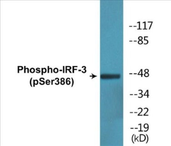 IRF-3 (phospho Ser386) Cell Based ELISA Kit