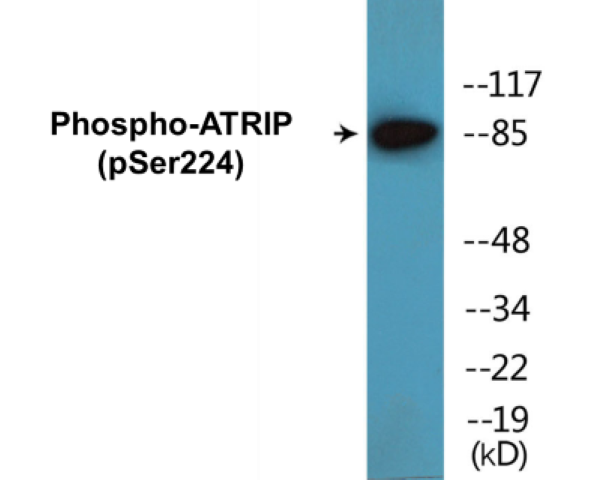 ATRIP (phospho Ser224) Cell Based ELISA Kit
