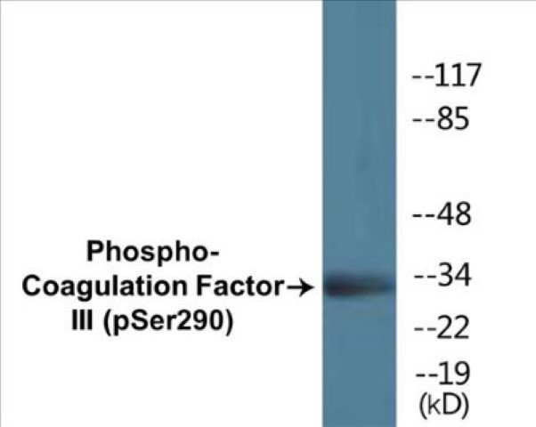 Coagulation Factor III (phospho Ser290) Cell Based ELISA Kit