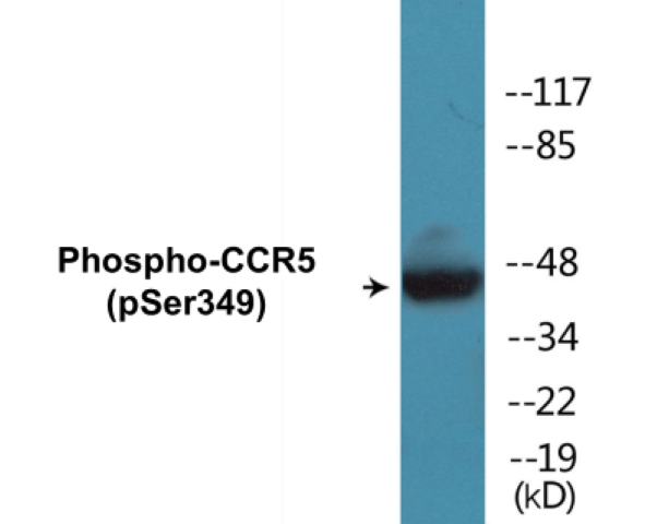 CCR5 (phospho Ser349) Cell Based ELISA Kit