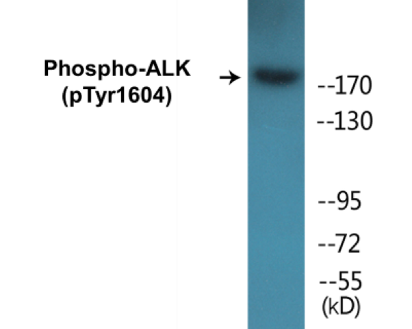 ALK (phospho Tyr1604) Cell Based ELISA Kit