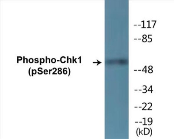 Chk1 (phospho Ser286) Cell Based ELISA Kit