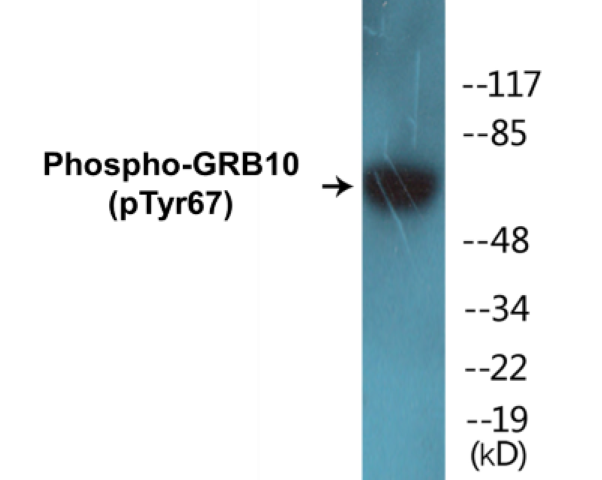 GRB10 (phospho Tyr67) Cell Based ELISA Kit