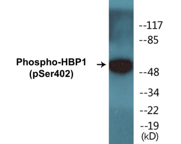 HBP1 (phospho Ser402) Cell Based ELISA Kit