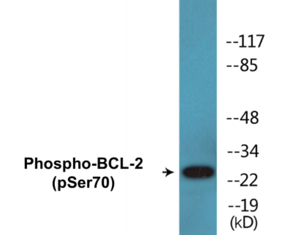 BCL-2 (phospho Ser70) Cell Based ELISA Kit