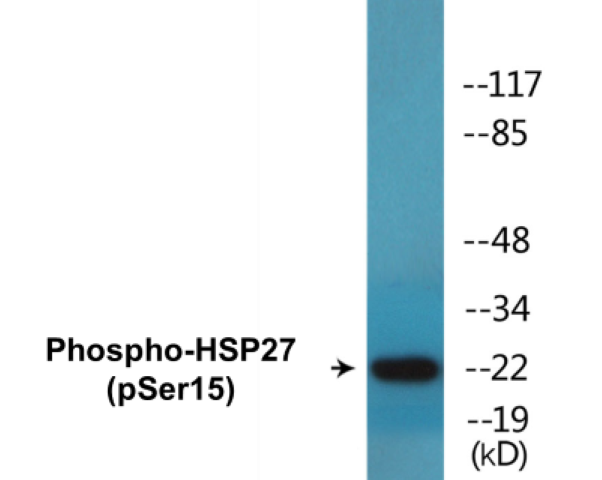HSP27 (phospho Ser15) Cell Based ELISA Kit