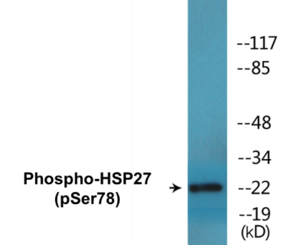 HSP27 (phospho Ser78) Cell Based ELISA Kit