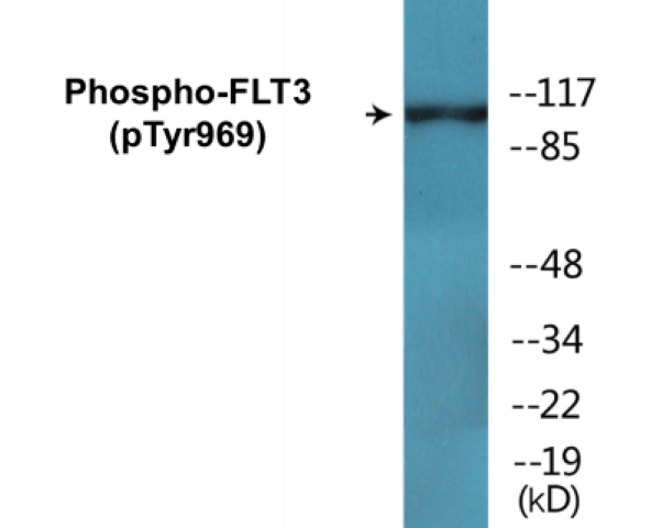 FLT3 (phospho Tyr969) Cell Based ELISA Kit