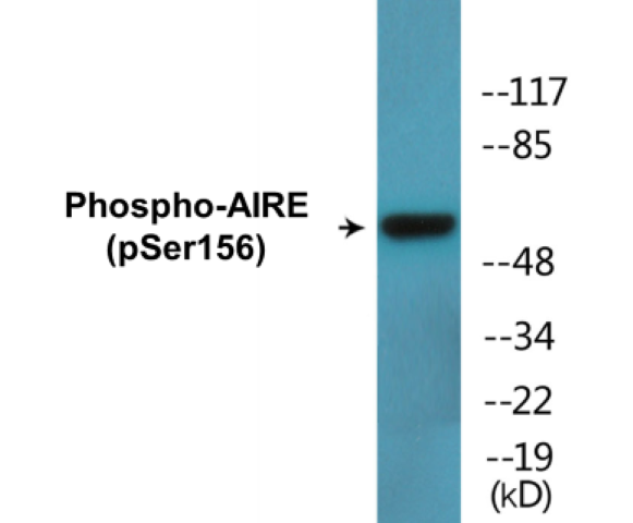 AIRE (phospho Ser156) Cell Based ELISA Kit