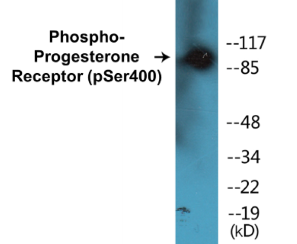 Progesterone Receptor (phospho Ser400) Cell Based ELISA Kit