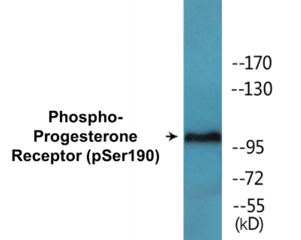 Progesterone Receptor (phospho Ser190) Cell Based ELISA Kit
