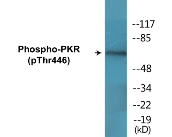 PKR (phospho Thr446) Cell Based ELISA Kit