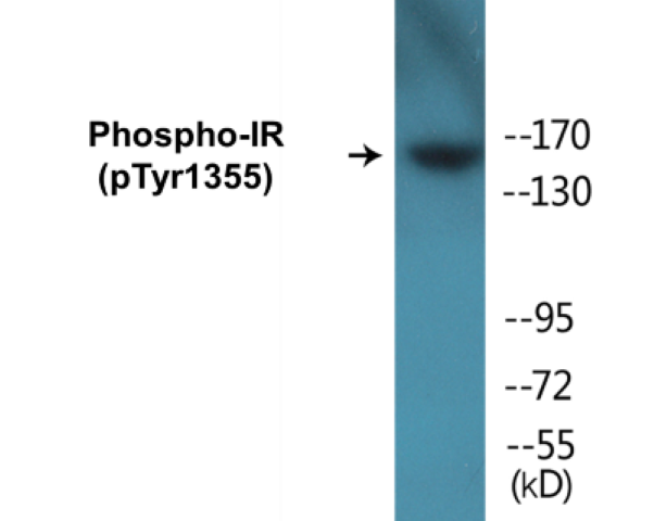 IR (phospho Tyr1355) Cell Based ELISA Kit