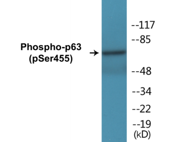 p63 (phospho Ser455) Cell Based ELISA Kit