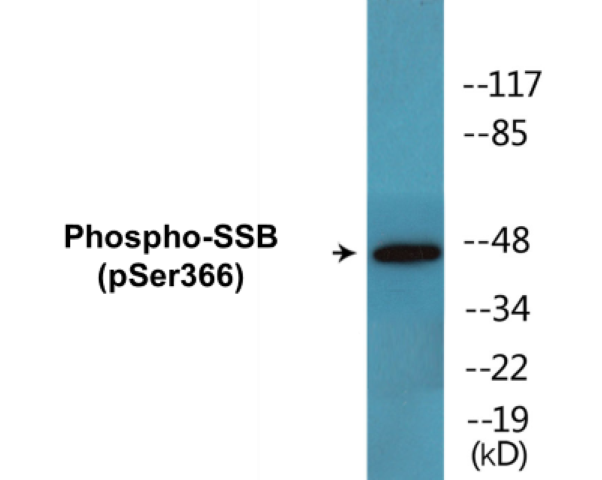 SSB (phospho Ser366) Cell Based ELISA Kit