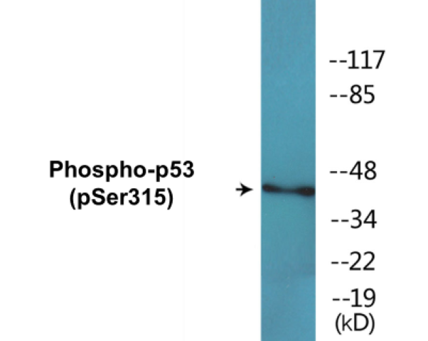 p53 (phospho Ser315) Cell Based ELISA Kit
