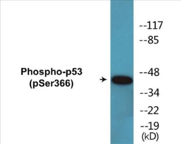 p53 (phospho Ser366) Cell Based ELISA Kit