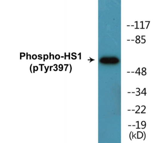 HS1 (phospho Tyr397) Cell Based ELISA Kit
