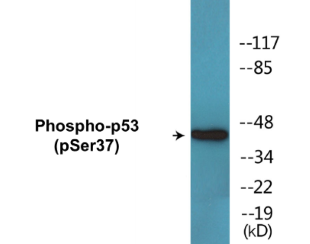 p53 (phospho Ser37) Cell Based ELISA Kit