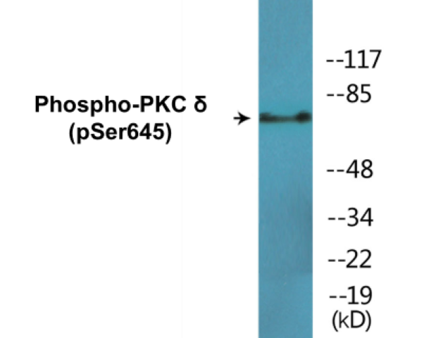 PKC delta (phospho Ser645) Cell Based ELISA Kit