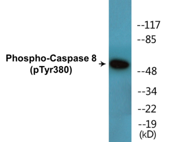 Caspase 8 (phospho Tyr380) Cell Based ELISA Kit