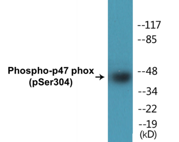 p47 phox (phospho Ser304) Cell Based ELISA Kit
