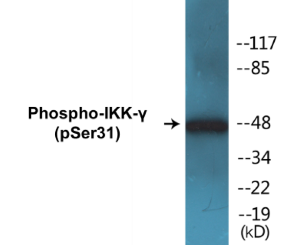 IKK gamma (phospho Ser31) Cell Based ELISA Kit