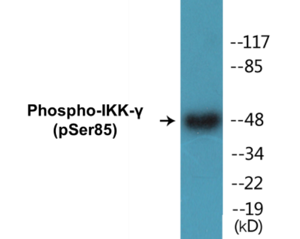 IKK gamma (phospho Ser85) Cell Based ELISA Kit