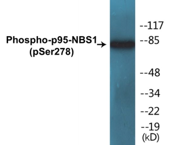 p95-NBS1 (phospho Ser278) Cell Based ELISA Kit