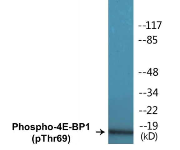 4E-BP1 (phospho Thr69) Cell Based ELISA Kit